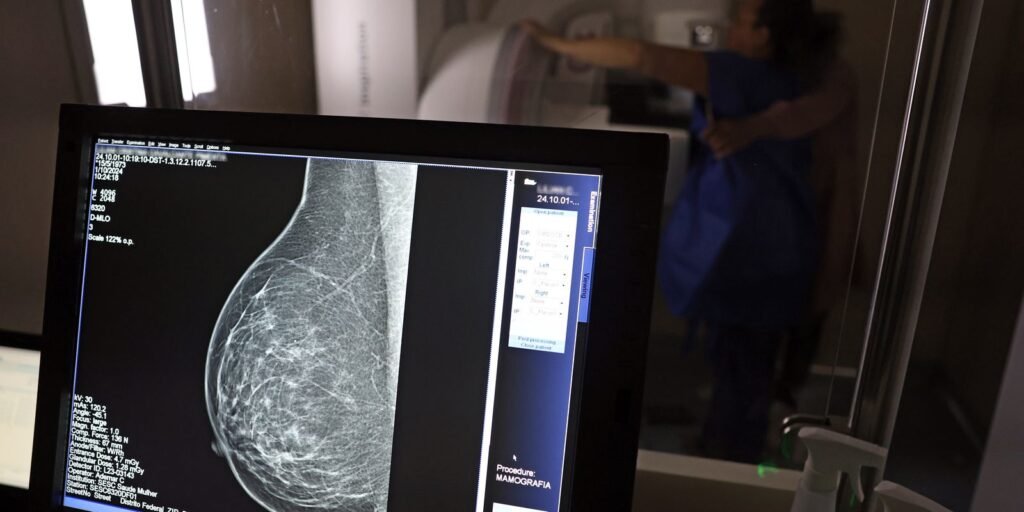 AGU processa médico que apontou mamografia como causadora de câncer AGU processa médico que apontou mamografia como causadora de câncer